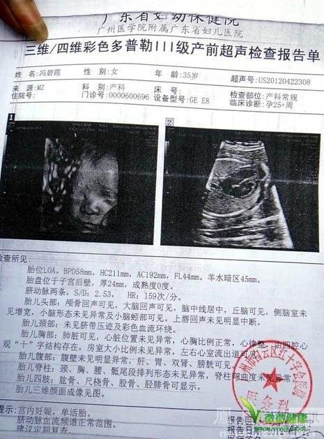 宝鸡白云高龄孕妇被告知胎儿畸形后跳楼身亡 